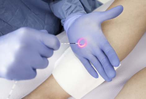 Kurs laseroterapii wewnątrzżylnej I stopień